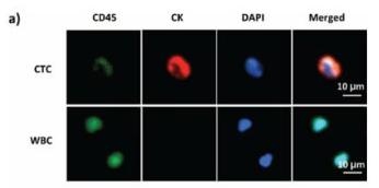循环肿瘤细胞（circulating tumour cell）