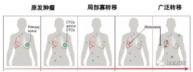肿瘤辅助诊断