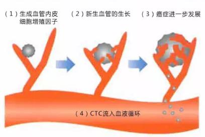 CTC检查是测定血液中流动癌细胞的一种检查