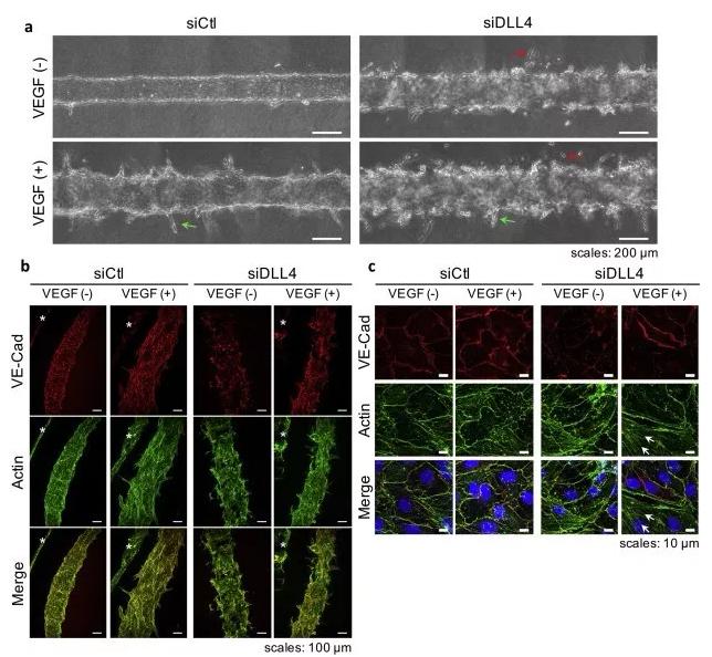 敲除DLL4将影响血管的新生和稳定性。图片来源：EBioMedicine