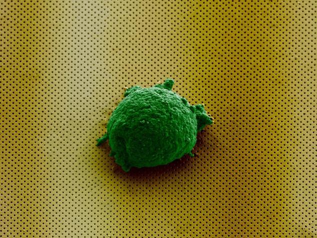 《Small》杂志封面图片显示，单个淋巴瘤细胞孤独地存在于新型生物传感器上。
